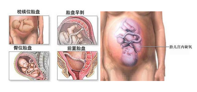 脱发、秃顶者得天下